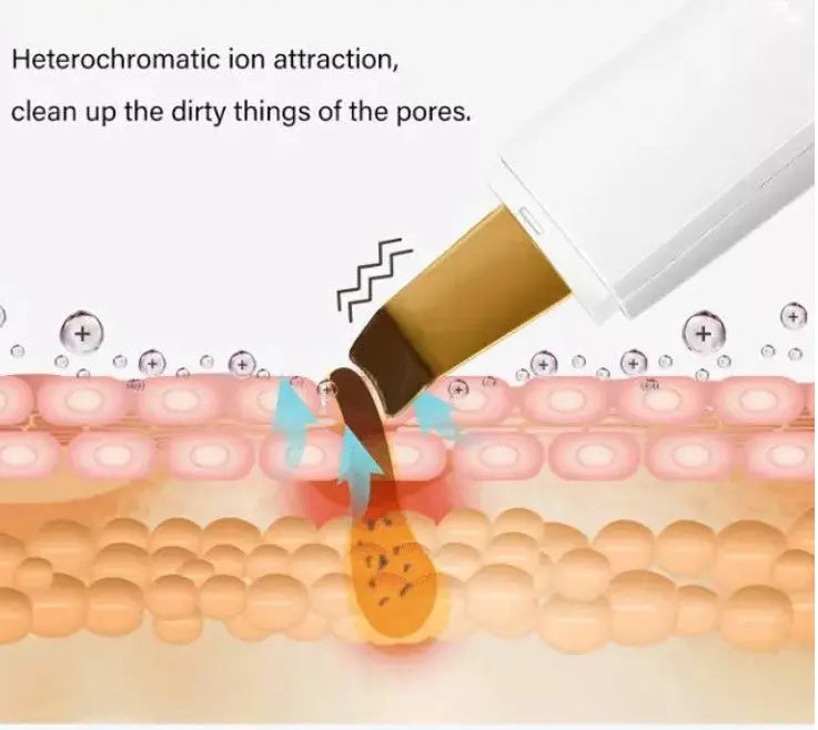 Ultrasonic beauty instrument - IM IN MY WORLD STORE.